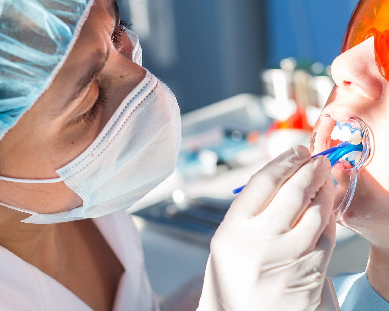 professional teeth whitening in singapore