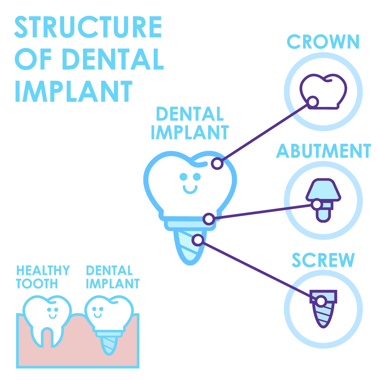 dental-implant-explained dental implant structure explained | Dental implant Singapore