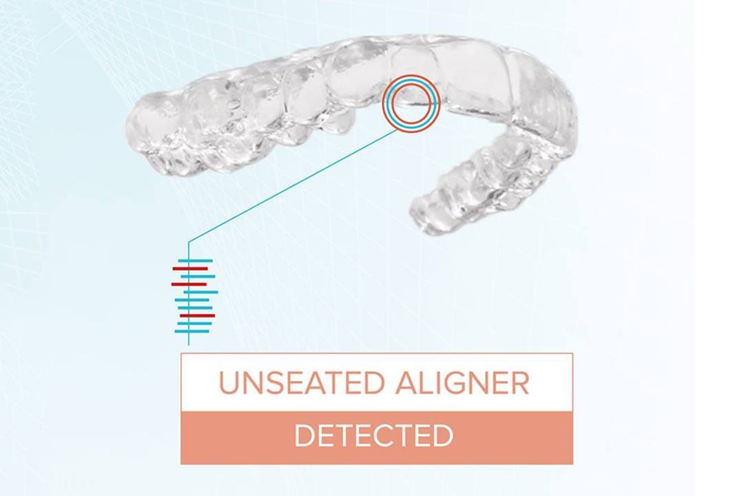 Unseated-Aligner dental monitoring artificial intelligence detecting unseated aligner