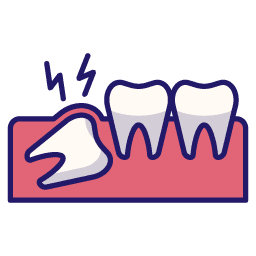 impacted wisdom tooth