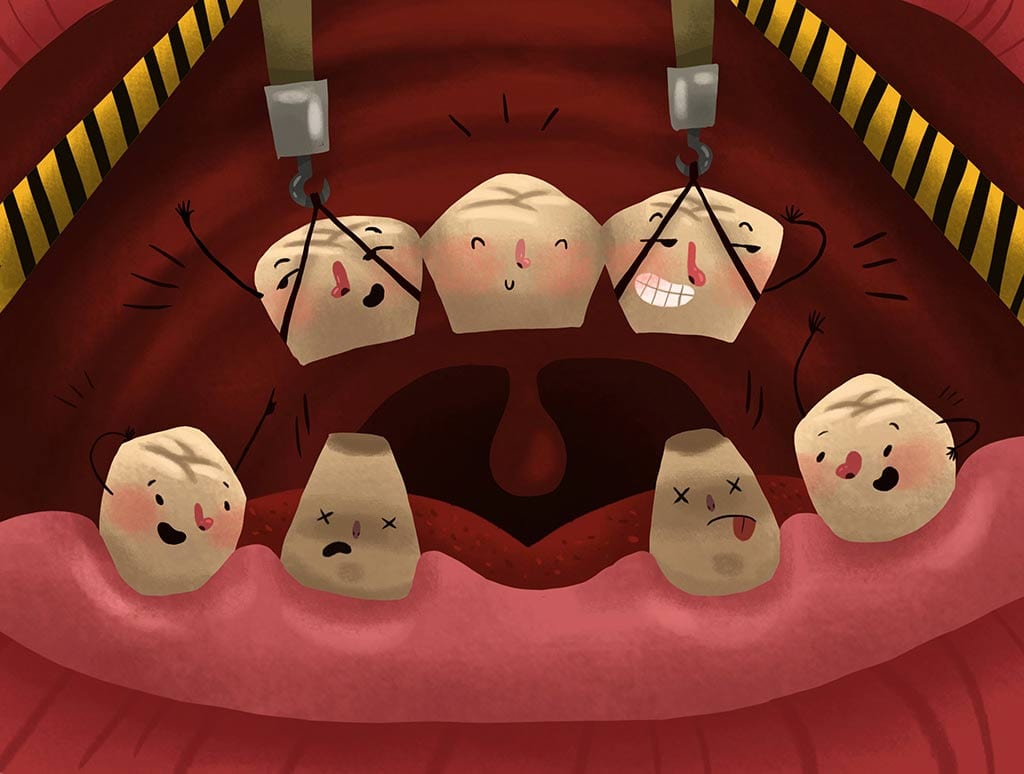 dental-bridge Dental Bridge