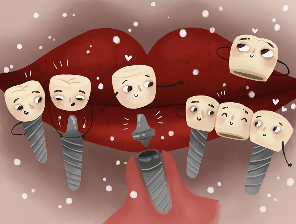 dental implants cartoon