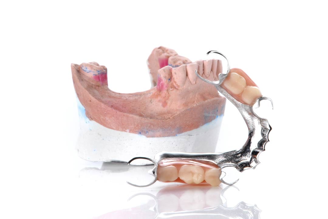 partial-dentures-resting-on-dental-mould partial dentures resting on a dental mould