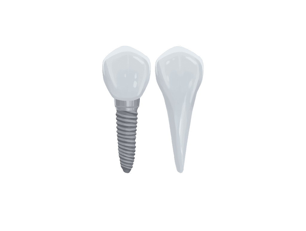 Mini-dental-implants Mini dental implants