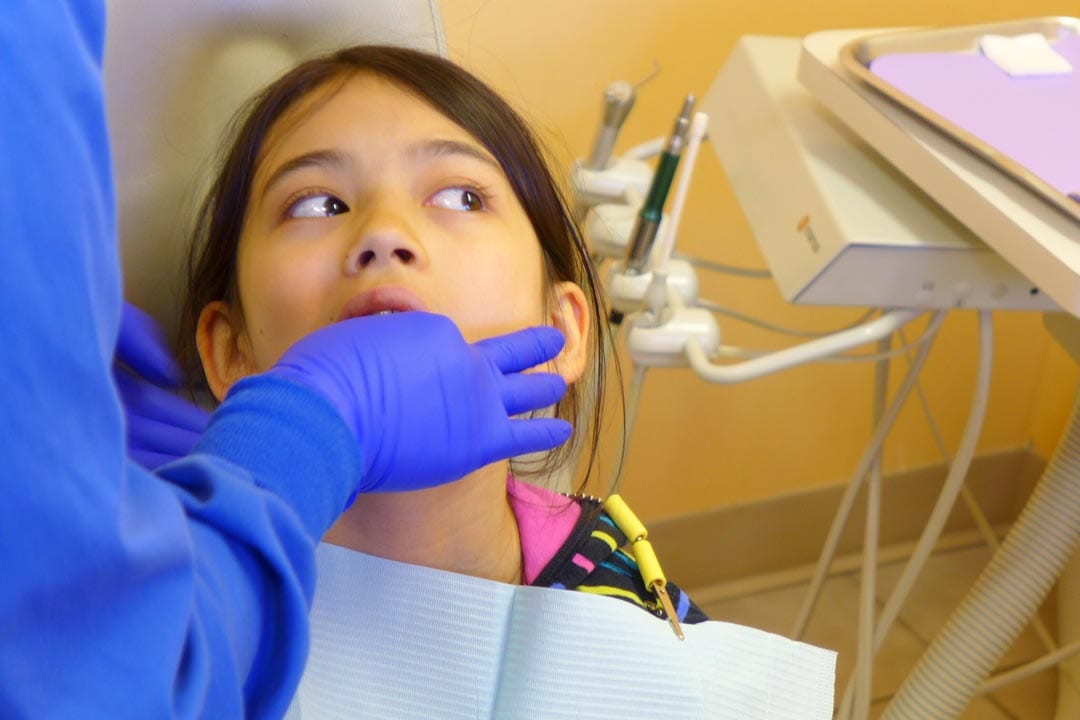 Dental mold taking for Invisalign First treatment in Singapore