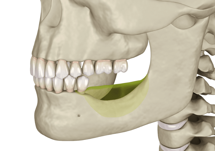 jaw bone loss jaw bone loss
