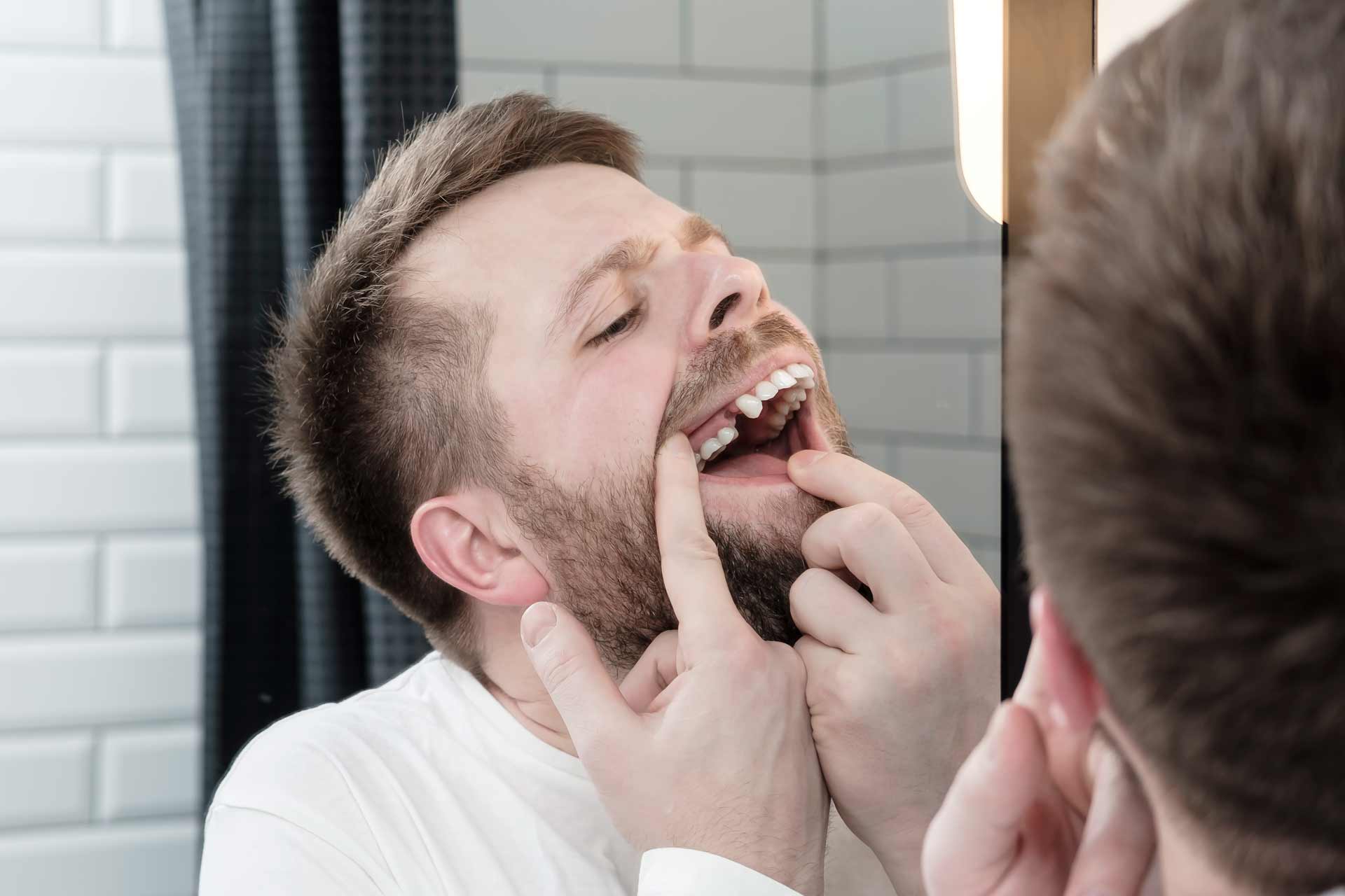 missing teeth in singapore