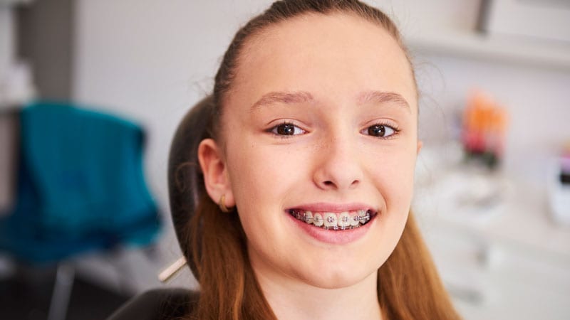 braces for teens in singapore