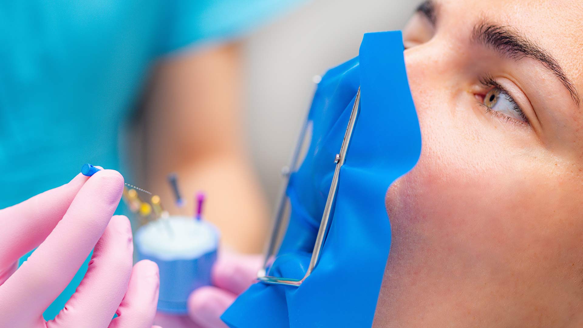 root canal treatment in singapore | endodontic treatment