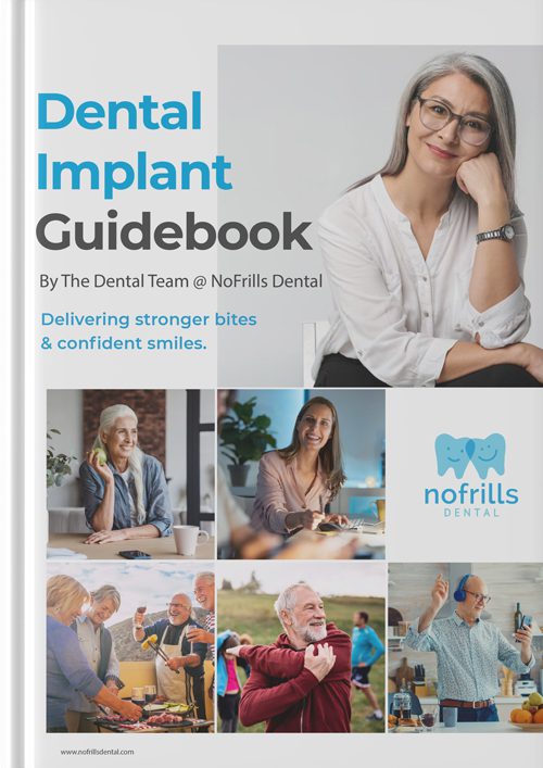 dental-implants-guidebook-cover dental implant guidebook cover