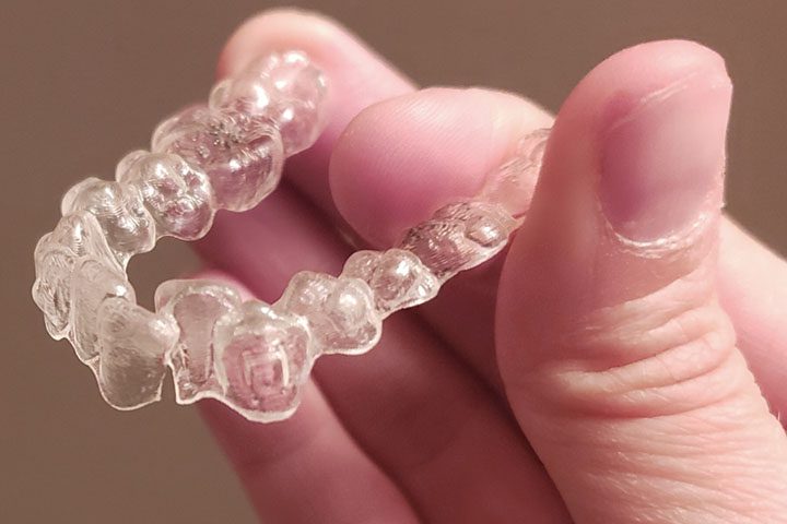 cracked invisalign cracked invisalign