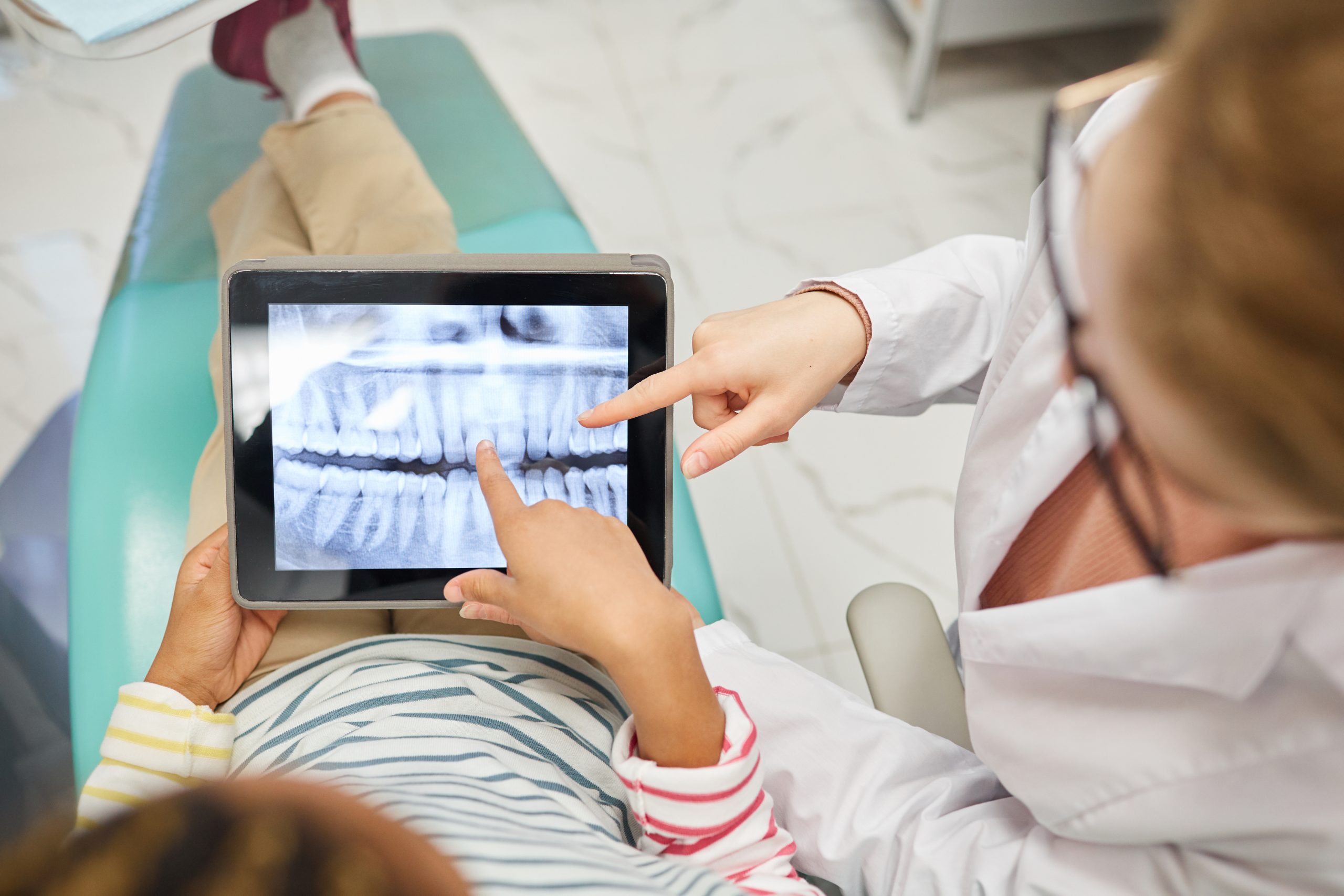 Patient's x-ray of teeth x-ray of patient teeth