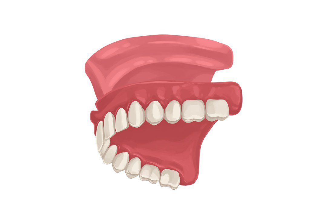 complete upper jaw denture