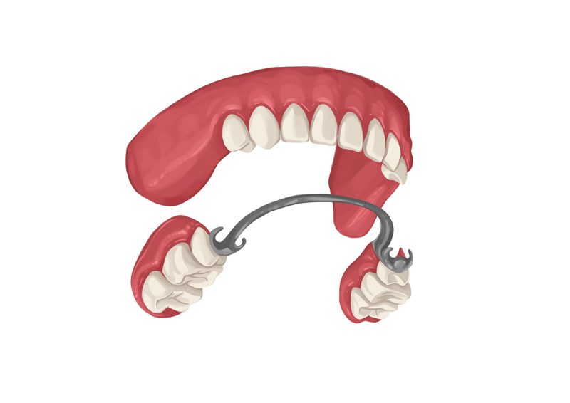 partial dentures
