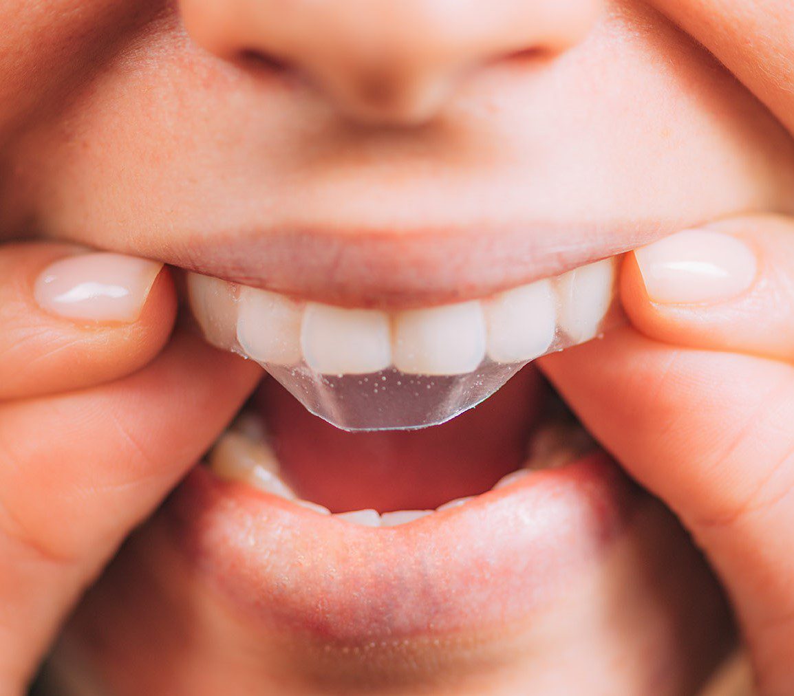 teeth whitening strip