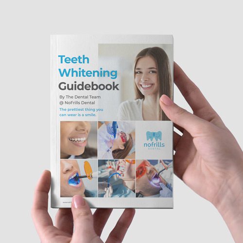 teeth-whitening-guidebook-cover Teeth Whitening Guidebook Cover