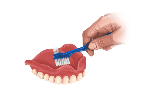 cleaning-dentures cleaning removable dentures