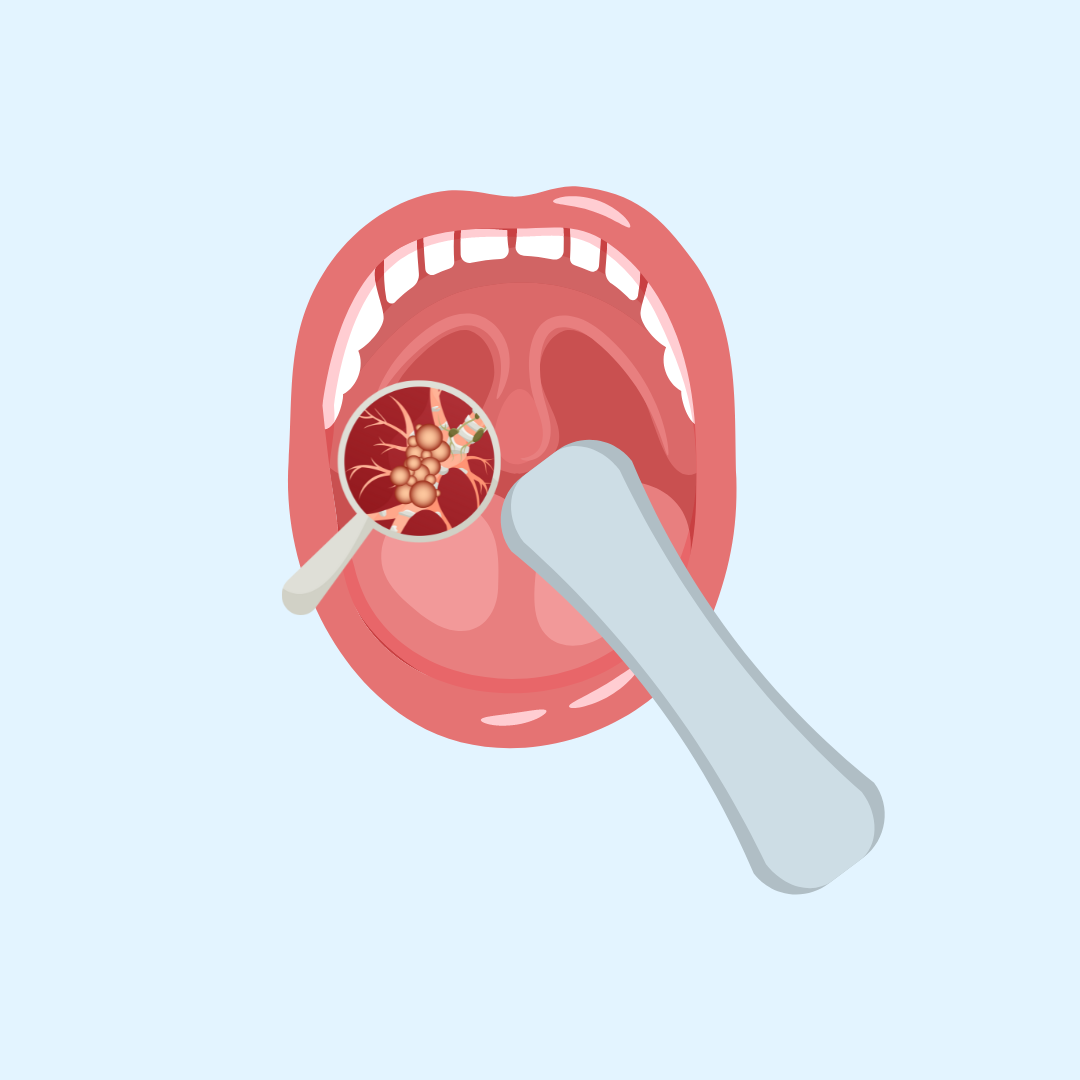 oralcancerrec Oral Cancer Rec