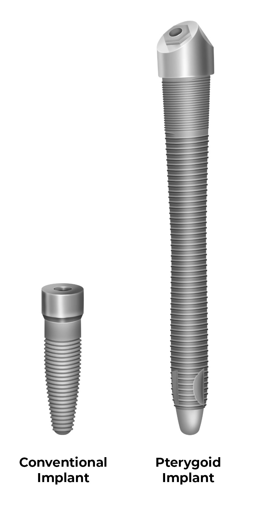Conventional Implants vs Pterygoid Implants