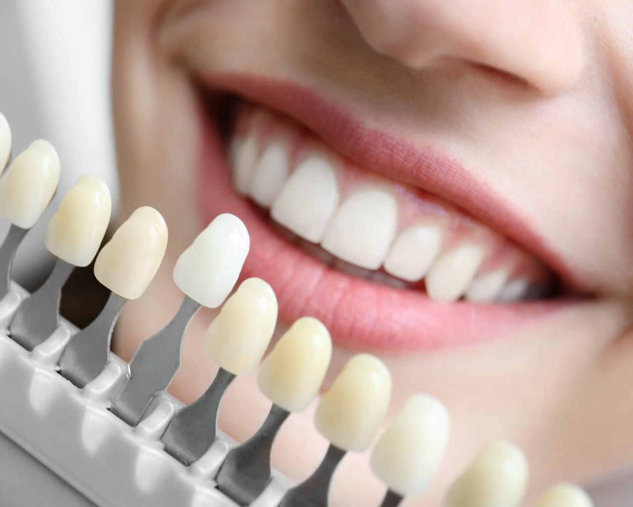 What is Cosmetic Dentistry? Is it Really Worth It?