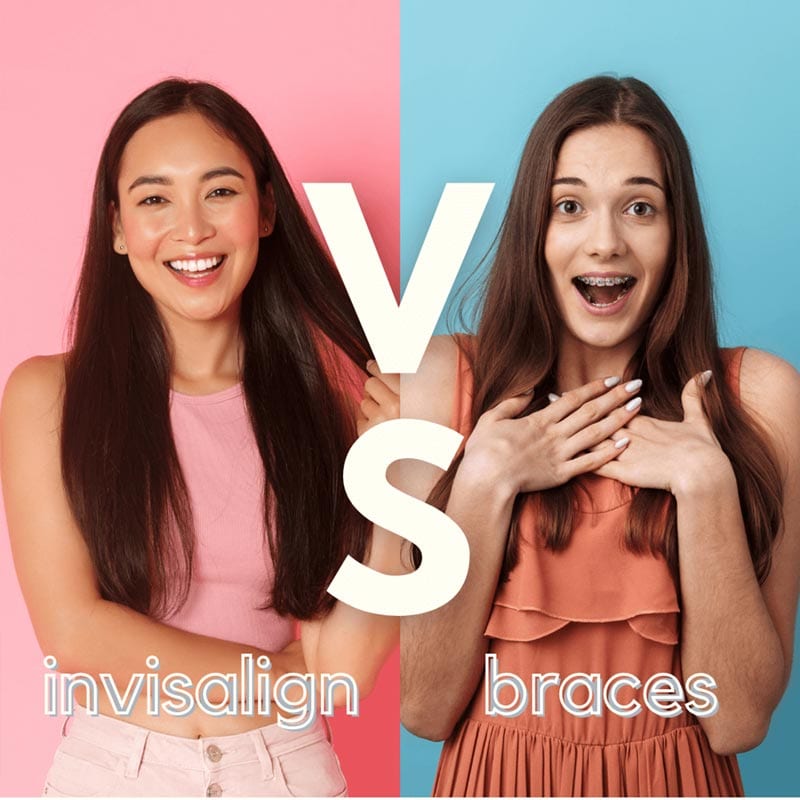 Invisalign vs braces in SIngapore