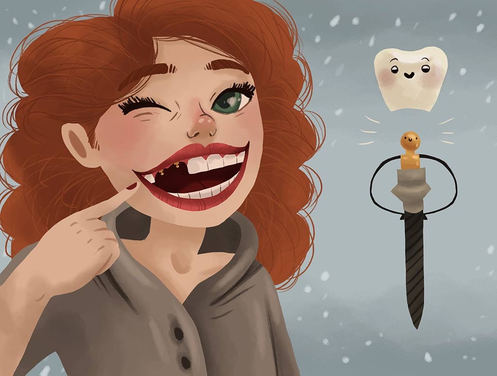 mini dental implants