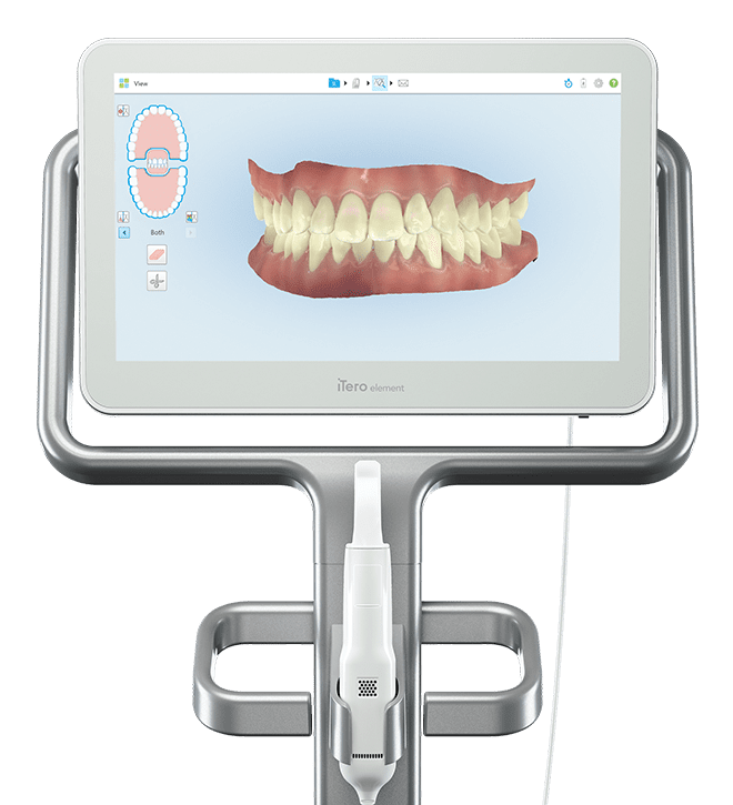 iTero Elements 2 intraoral scanner | Digital Dentistry in Singapore