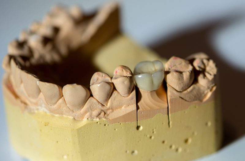 dental crown on mold