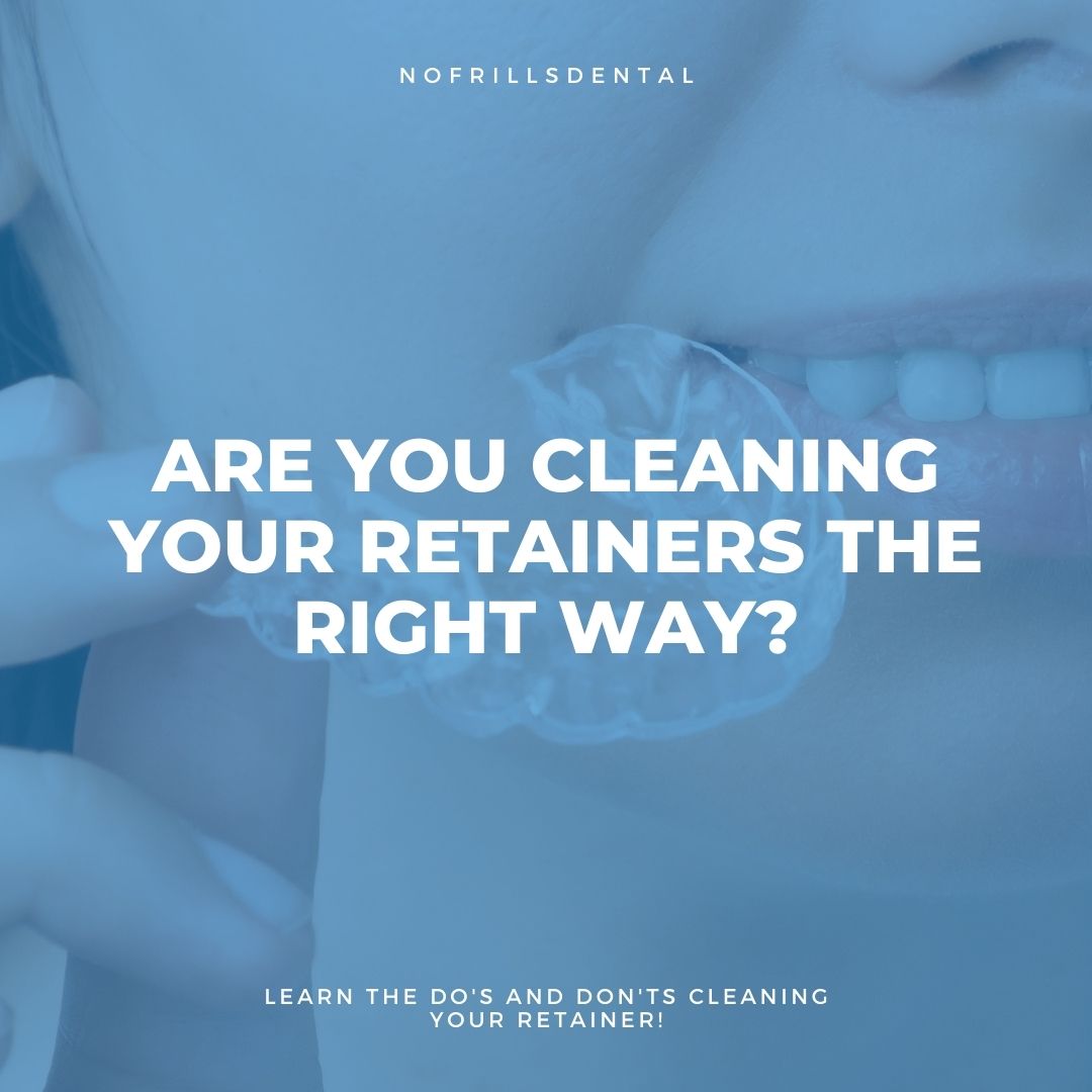 How to clean retainers featured image