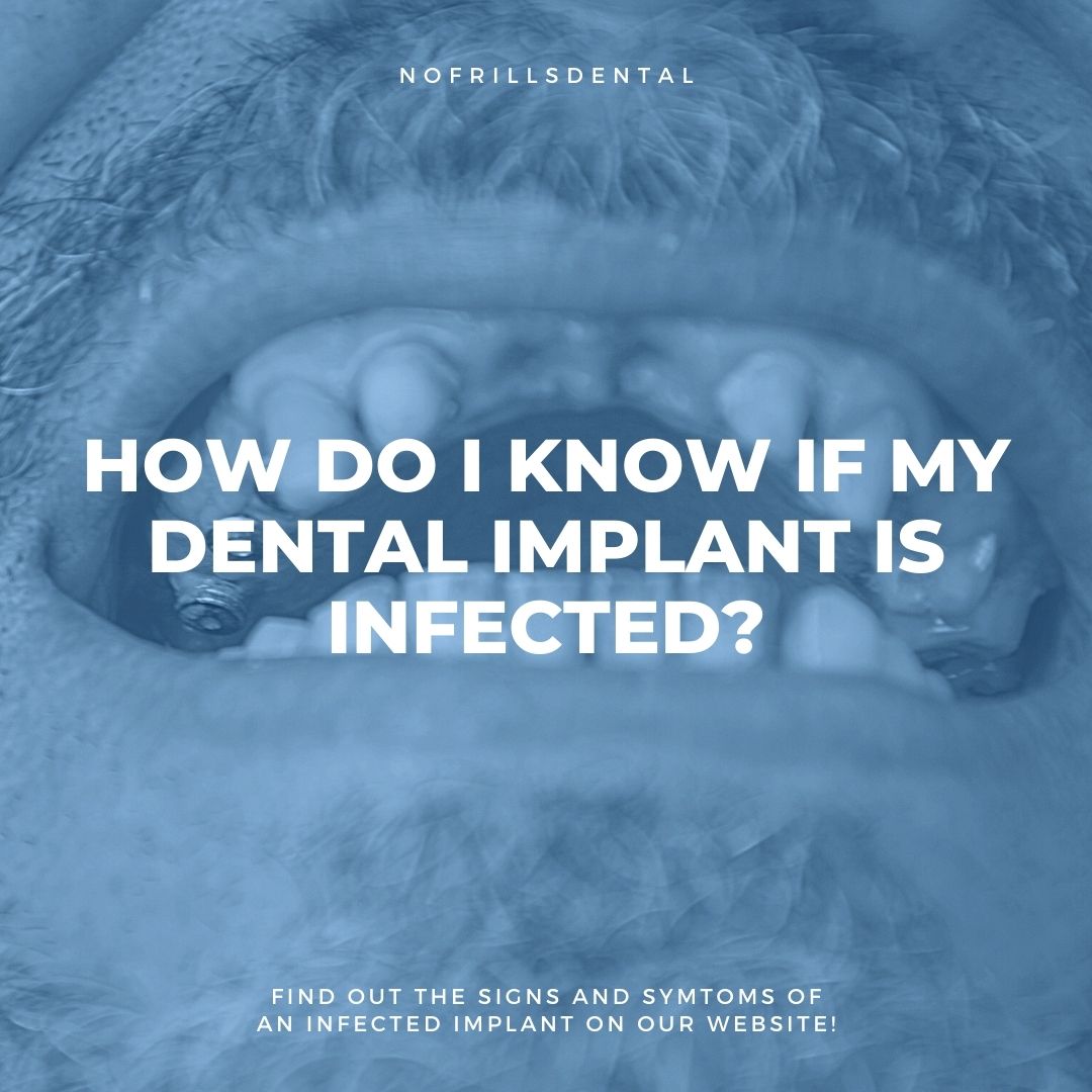how do I know if my dental implant is infected?