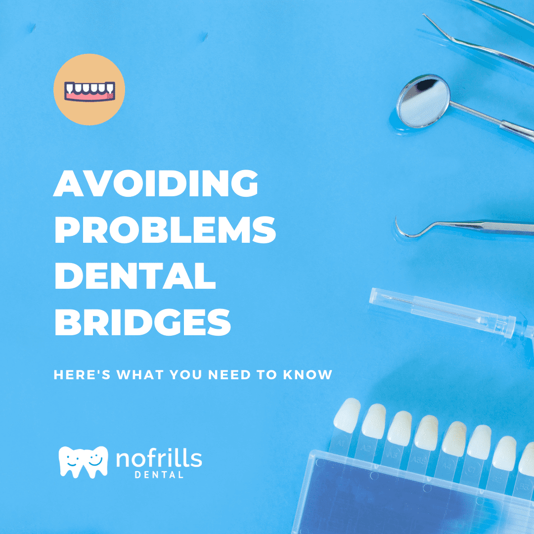 How to avoid problems with dental bridges