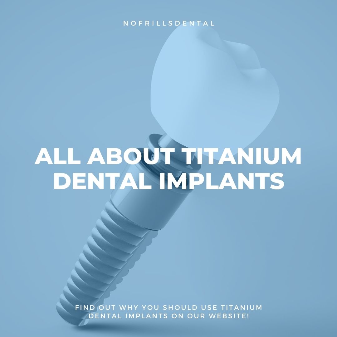 All About Titanium Dental Implants
