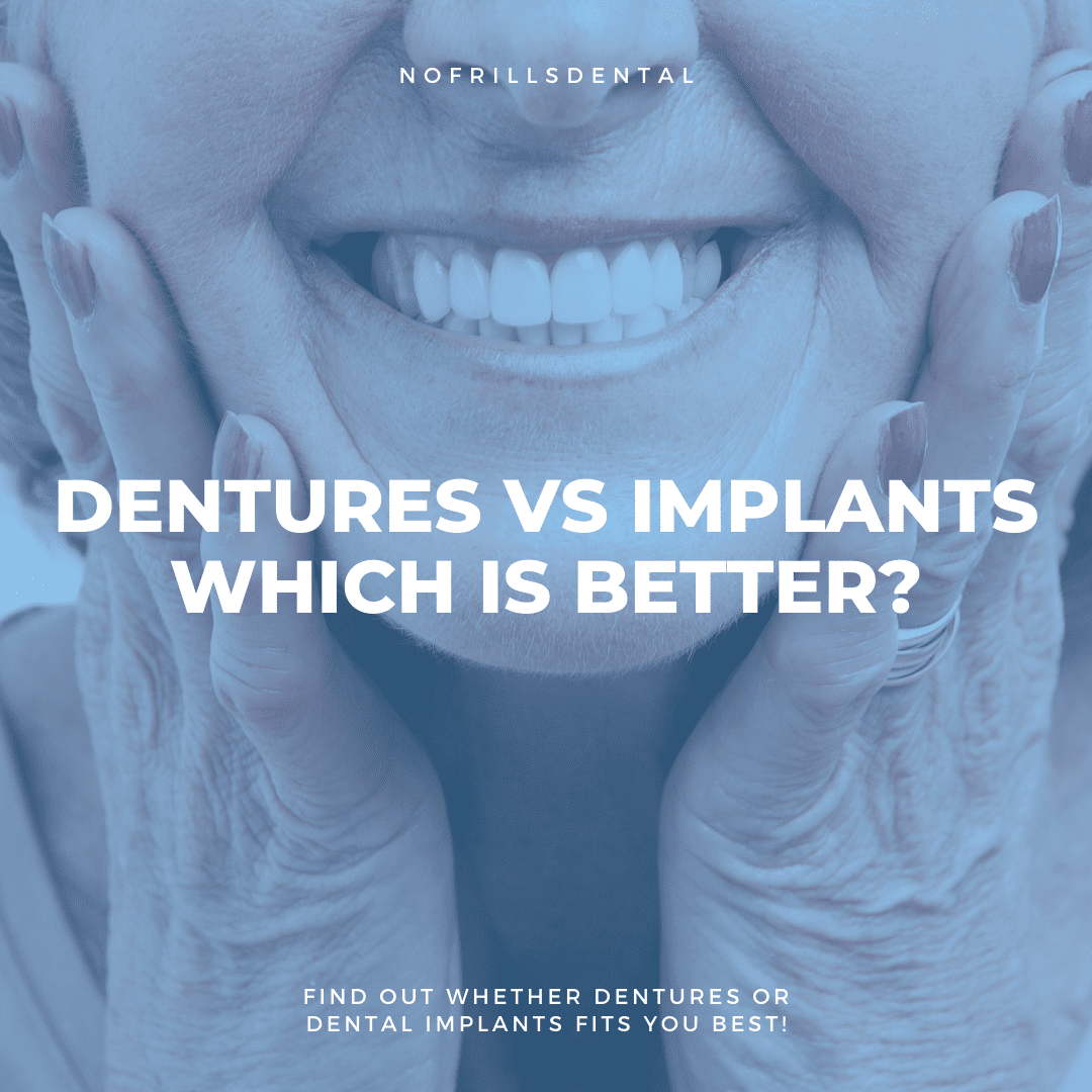 Dental Implants vs Dentures – which is the better option?