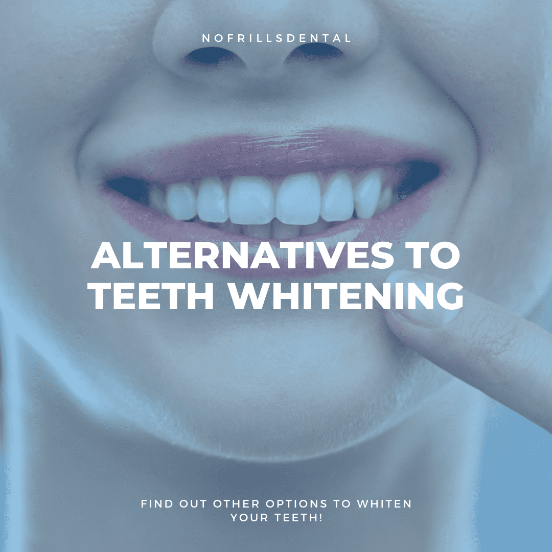 Alternatives to Teeth Whitening
