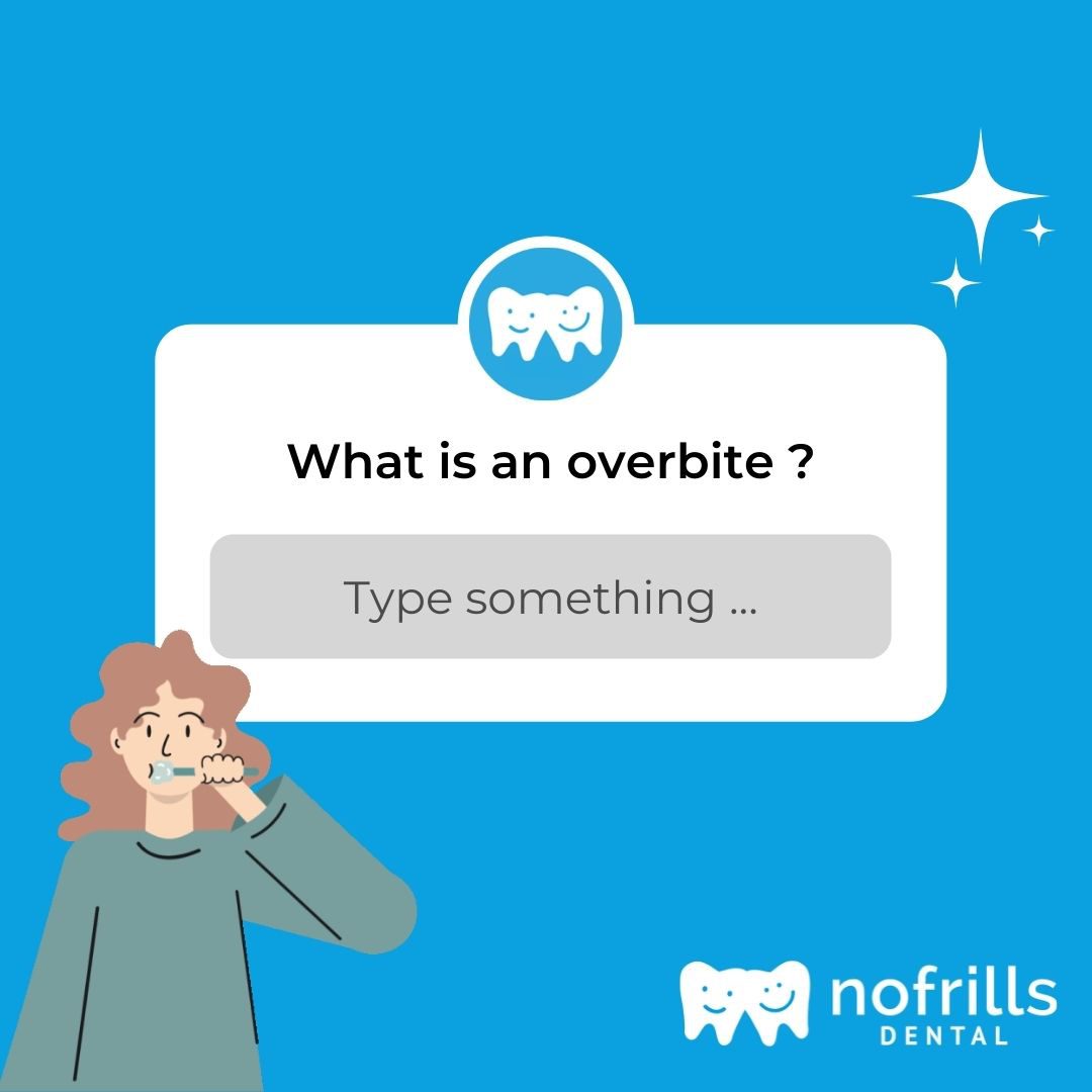 overbite featured image