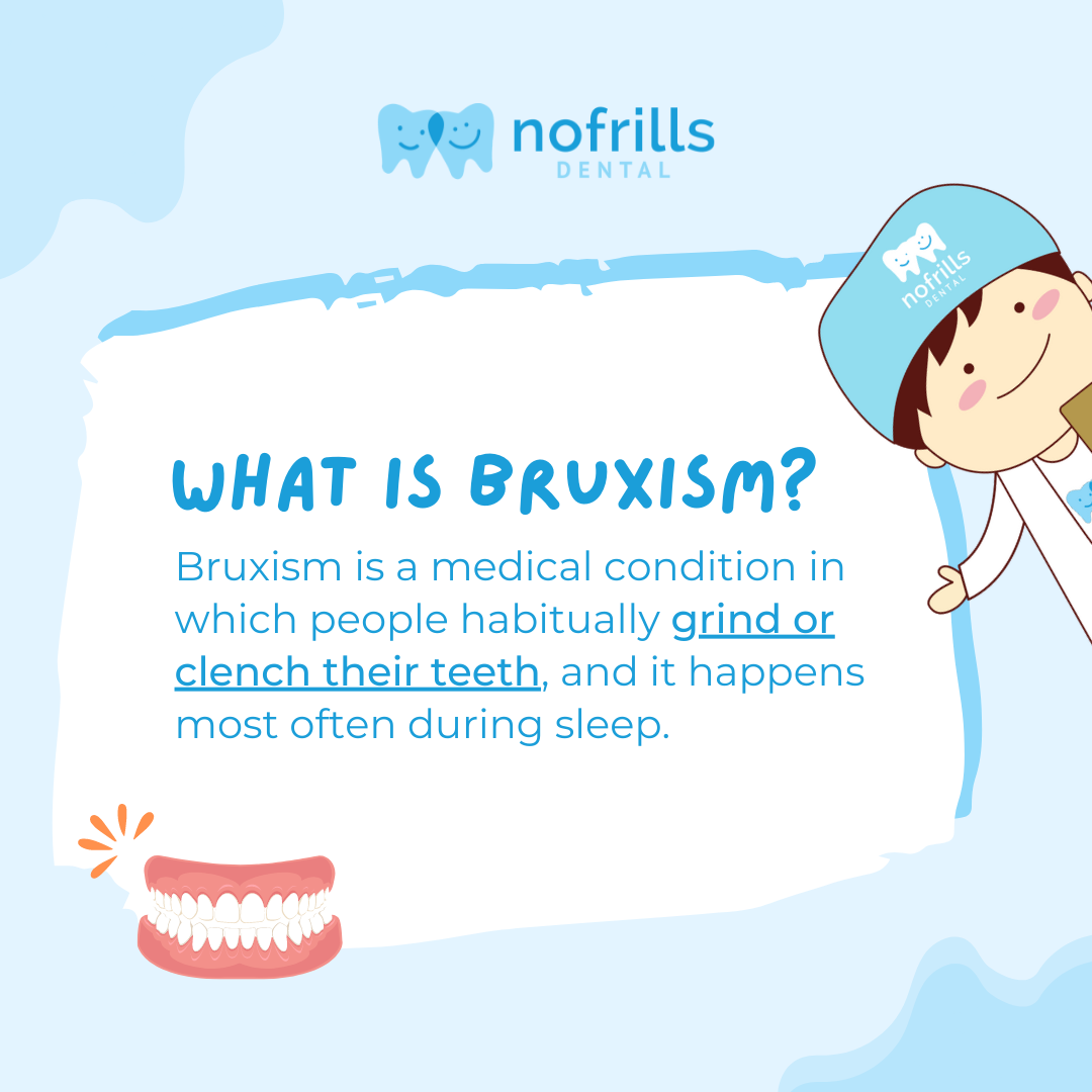 Bruxism