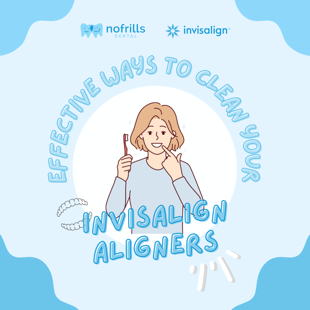 Effective ways to clean your Invisalign Aligners
